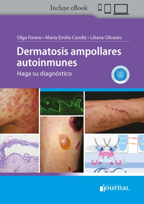 Cover image for book Dermatosis ampollares autoinmunes