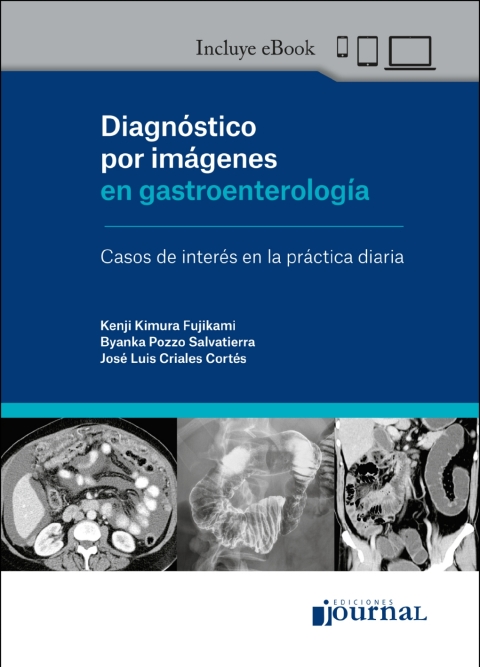 Cover image for book Diagnóstico por imágenes en gastroenterología