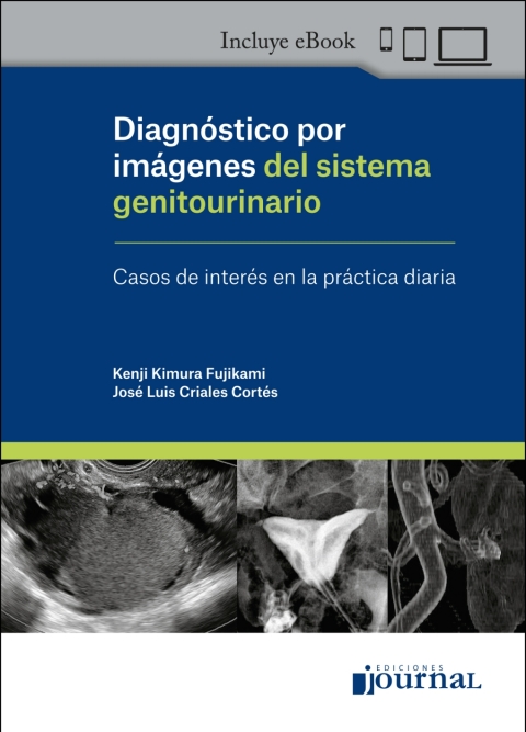 Cover image for book Diagnóstico por imágenes del sistema genitourinario