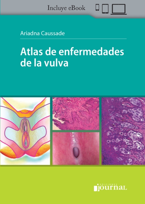 Cover image for book Atlas de enfermedades de la vulva