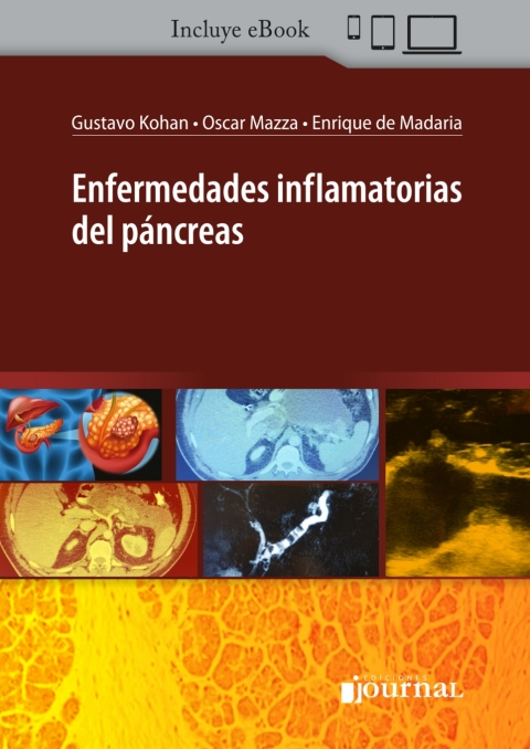 Cover image for book Enfermedades inflamatorias del páncreas