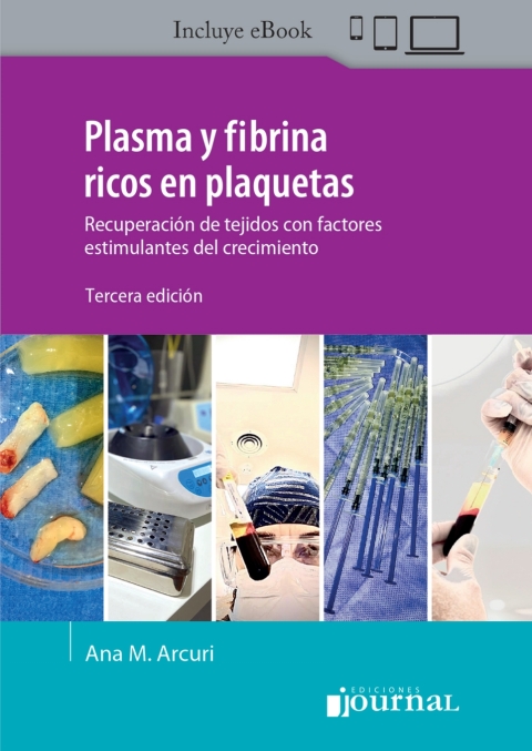 Cover image for book Plasma y fibrina rico en plaquetas