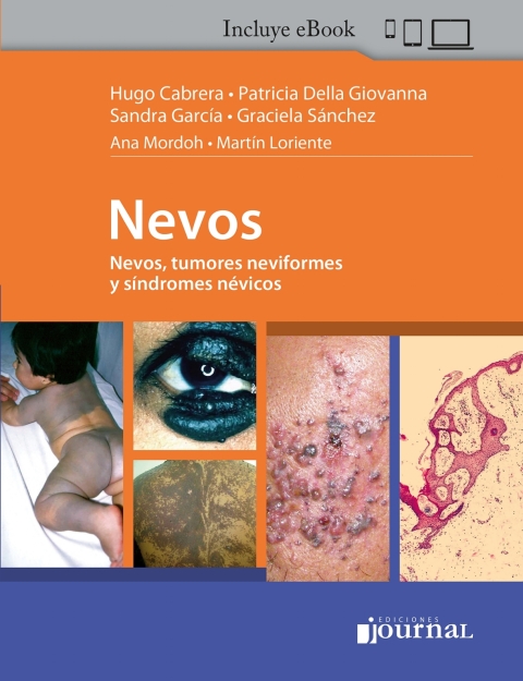 Cover image for book Nevos