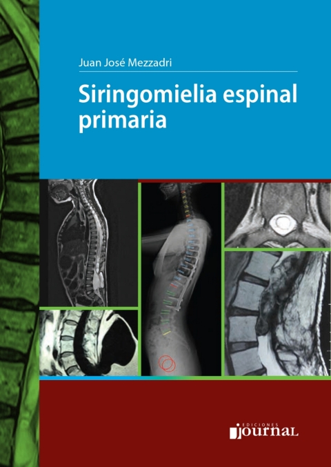 Cover image for book Siringomielia espinal primaria