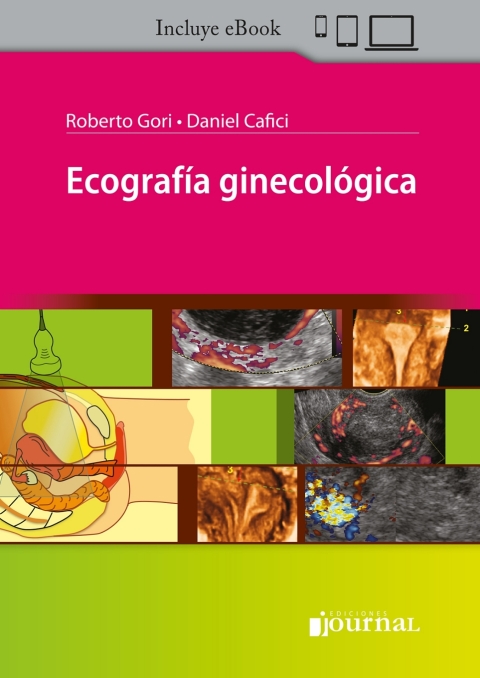 Cover image for book Ecografia ginecologica