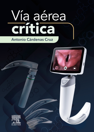 Vía aérea crítica