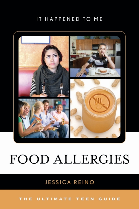 Cover image for book Food Allergies