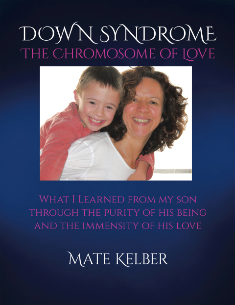 Cover image for book DOWN SYNDROME The Chromosome of Love