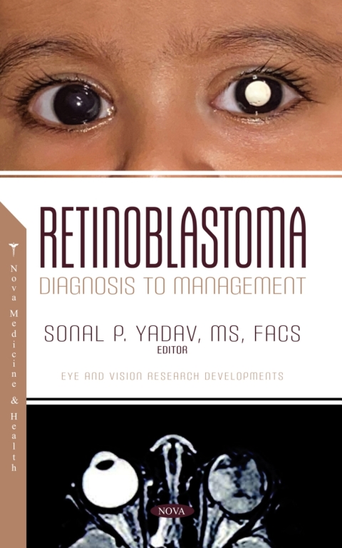 Cover image for book Retinoblastoma: Diagnosis to Management