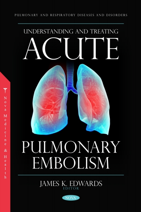 Cover image for book Understanding and Treating Acute Pulmonary Embolism