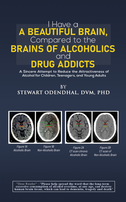 Cover image for book I Have a Beautiful Brain, Compared to the Brains of Alcoholics and Drug Addicts