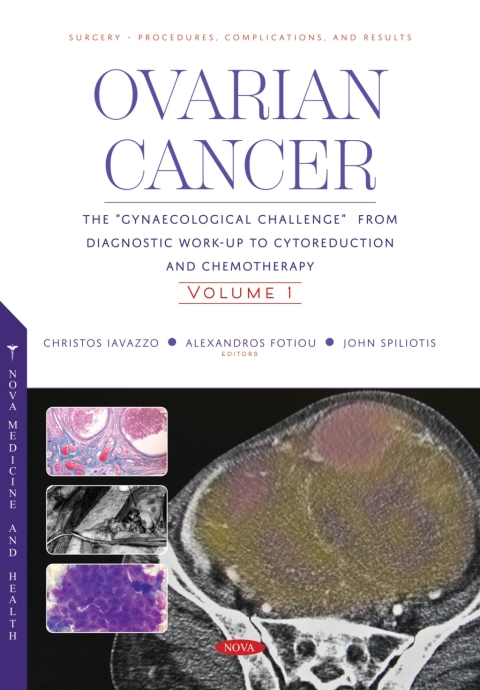 Cover image for book Ovarian Cancer: The “Gynaecological Challenge” from Diagnostic Work-Up to Cytoreduction and Chemotherapy. Volume 1