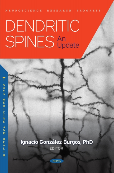 Cover image for book Dendritic Spines: An Update