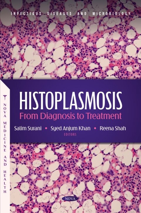 Cover image for book Histoplasmosis: From Diagnosis to Treatment