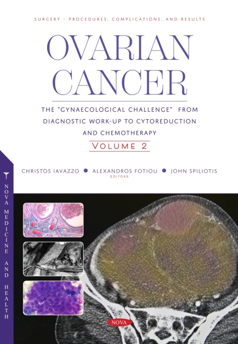 Cover image for book Ovarian Cancer: The “Gynaecological Challenge” from Diagnostic Work-Up to Cytoreduction and Chemotherapy. Volume 2