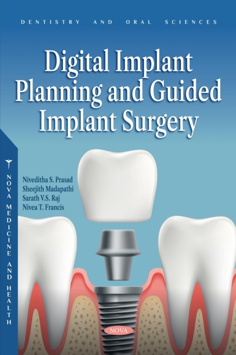 Cover image for book Digital Implant Planning and Guided Implant Surgery
