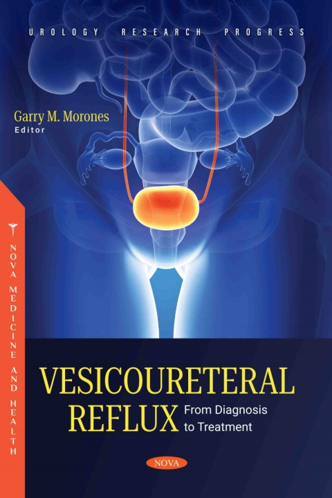Cover image for book Vesicoureteral Reflux: From Diagnosis to Treatment