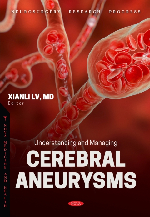 Cover image for book Understanding and Managing Cerebral Aneurysms