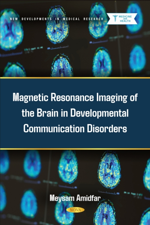 Cover image for book Magnetic Resonance Imaging of the Brain in Developmental Communication Disorders