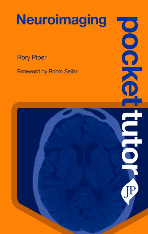 Cover image for book Pocket Tutor: Neuroimaging
