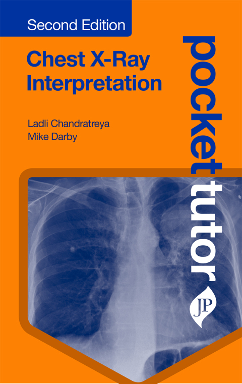 Cover image for book Pocket Tutor: Chest X-Ray Interpretation