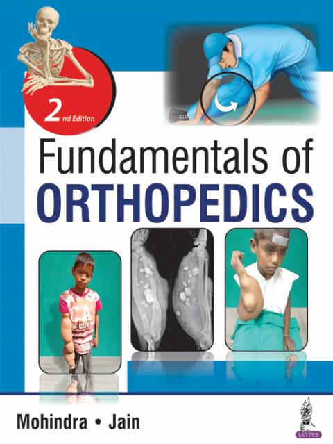 Cover image for book Fundamentals of Orthopedics